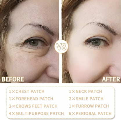 Anti Wrinkle Patches, 18 Pcs, Forehead Wrinkle Patches